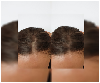 Follixin capsules for hair loss with a thickening and strengthening effect 60 capsules