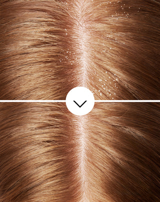 Nutridome anti-dandruff shampoo with piroctone olamine with a moisturising effect - 5