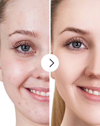 Derminax tablets with zinc and vitamins C, E and B2 for acne, blemishes and imperfections - 5