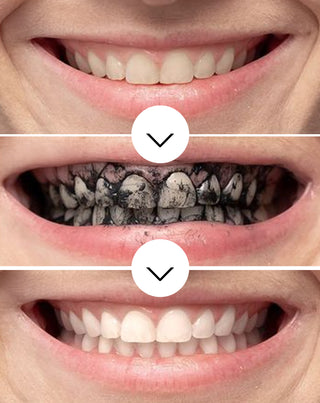 Smilebite coconut charcoal teeth whitening powder