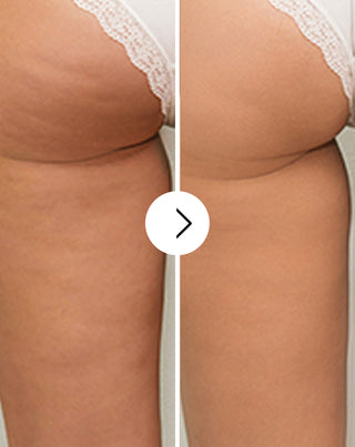 Cellinea tablets for cellulite and improving skin condition with natural extracts 60 capsules - 5