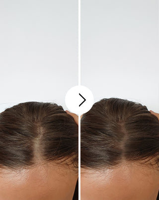 Follixin capsules for hair loss with a thickening and strengthening effect 60 capsules