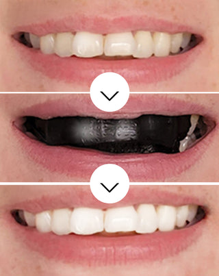 The White(ning) Stripes Smilebite teeth whitening strips set of 28 pcs. - 4